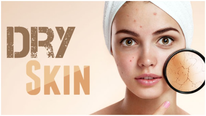 Dry Skin Problem : ड्राई स्किन है तो हो सकती है ये बड़ी बीमारी, नज़रअंदाज़ करने का खतरा न लें