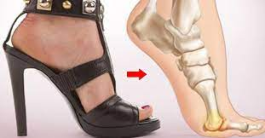 High Heels Side Effects: क्या आप हाई हील्स पहनती है? तो जान लें इसके नुकसान