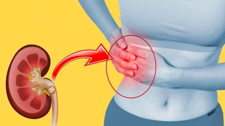 Kidney Stone : पथरी होने पर क्या खाएं और किस चीज़ से करें परहेज?