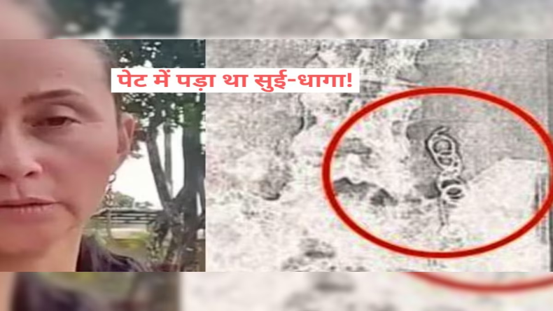 महिला को 11 सालों से पेट में हो रहा था दर्द, एक्सरे करवाया तो डॉक्टर के उड़े होश