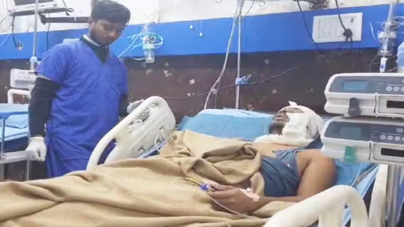 Hajipur Acid Attack: शादीशुदा प्रेमिका से मिलने गया था प्रेमी, हाजीपुर में हुआ एसिड अटैक