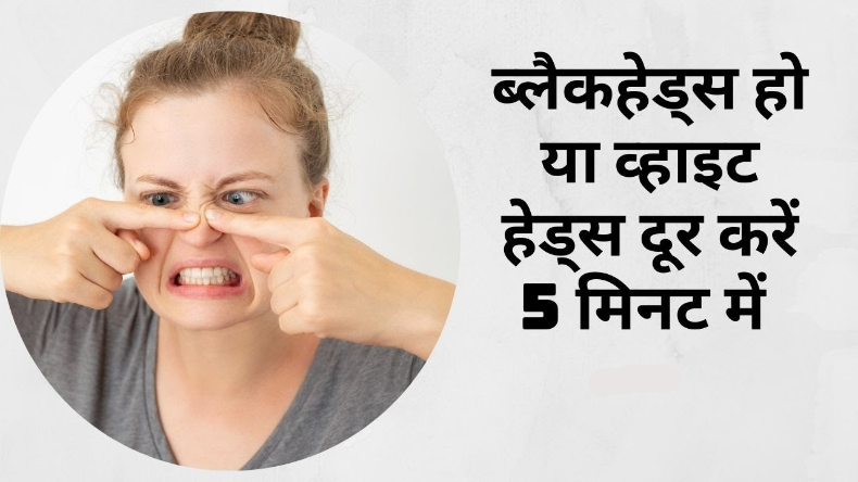 Skin Care: ब्लैकहेड्स – व्हाइटहेड्स से पाना चाहते हैं छुटकारा, तो यूज़ करें ये चावल से बना स्क्रब